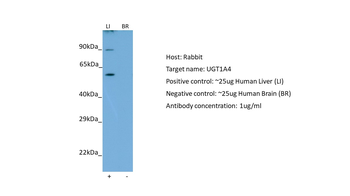 UGT1A4 Rabbit Polyclonal Antibody