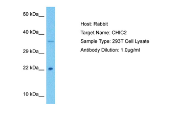 CHIC2 Rabbit Polyclonal Antibody