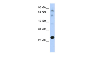 CHIC2 Rabbit Polyclonal Antibody