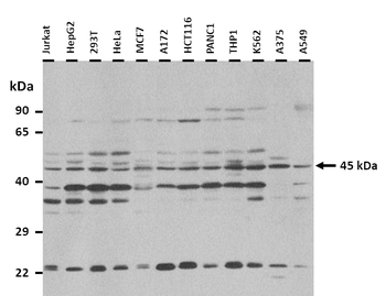 FKBP8 Rabbit Polyclonal Antibody