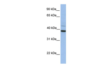 FKBP8 Rabbit Polyclonal Antibody