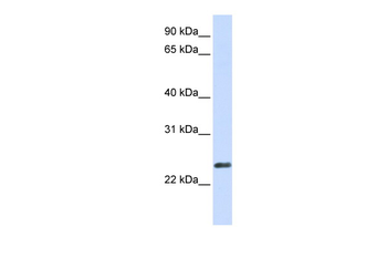 ERVWE1 Rabbit Polyclonal Antibody