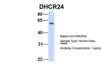 DHCR24 Rabbit Polyclonal Antibody