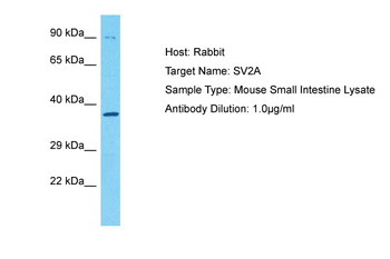 SV2A Rabbit Polyclonal Antibody