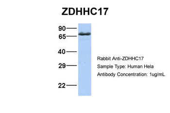 ZDHHC17 Rabbit Polyclonal Antibody