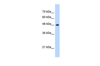 UNC84B Rabbit Polyclonal Antibody