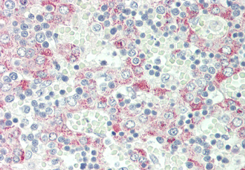 Clec1b Rabbit Polyclonal Antibody