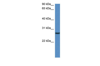 Clec1b Rabbit Polyclonal Antibody