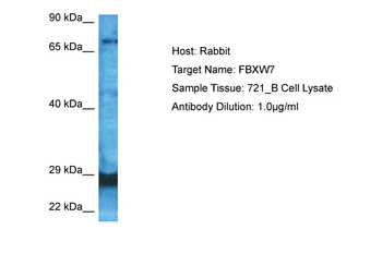FBXW7 Rabbit Polyclonal Antibody