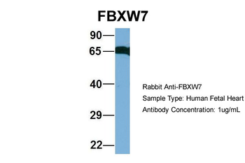FBXW7 Rabbit Polyclonal Antibody