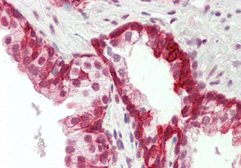 KRT19 Rabbit Polyclonal Antibody