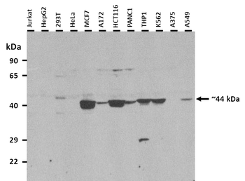 KRT19 Rabbit Polyclonal Antibody