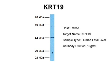 KRT19 Rabbit Polyclonal Antibody