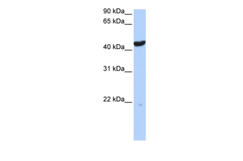KRT23 Rabbit Polyclonal Antibody