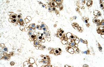 UNCX Rabbit Polyclonal Antibody