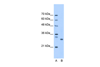 PSMC3IP Rabbit Polyclonal Antibody