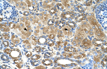 UBXD2 Rabbit Polyclonal Antibody