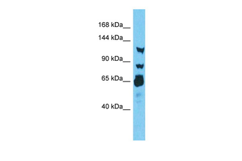 RNF213 Rabbit Polyclonal Antibody