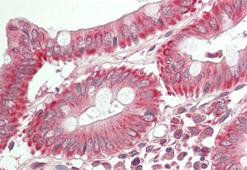 RNF213 Rabbit Polyclonal Antibody