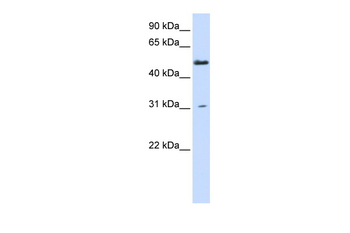 AGXT2L2 Rabbit Polyclonal Antibody