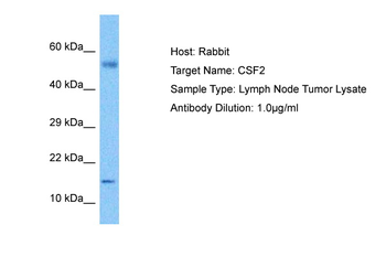 CSF2 Rabbit Polyclonal Antibody