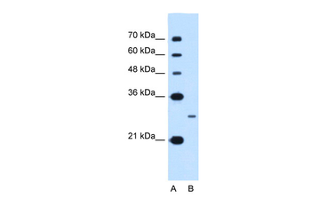 NANOG Rabbit Polyclonal Antibody