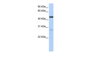 NR2F1 Rabbit Polyclonal Antibody