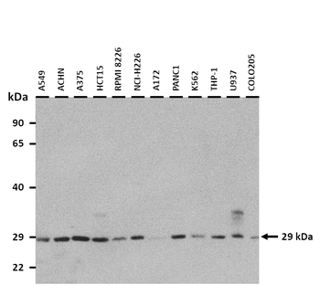 DKK1 Rabbit Polyclonal Antibody