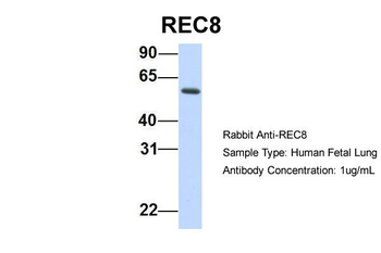 REC8 Rabbit Polyclonal Antibody