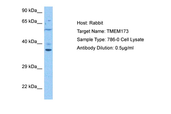 TMEM173 Rabbit Polyclonal Antibody
