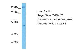 TMEM173 Rabbit Polyclonal Antibody
