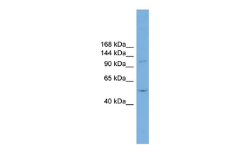 TNNI3K Rabbit Polyclonal Antibody