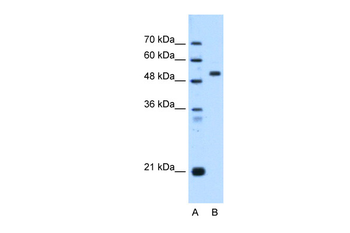 ST14 Rabbit Polyclonal Antibody