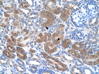 CD36 Rabbit Polyclonal Antibody