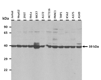 ALDOA Rabbit Polyclonal Antibody
