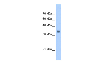 ALDOA Rabbit Polyclonal Antibody