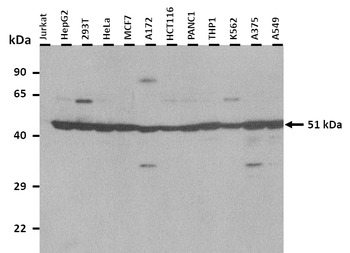 HADHB Rabbit Polyclonal Antibody