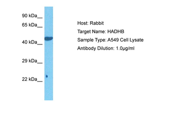 HADHB Rabbit Polyclonal Antibody