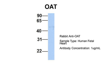 OAT Rabbit Polyclonal Antibody