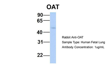 OAT Rabbit Polyclonal Antibody