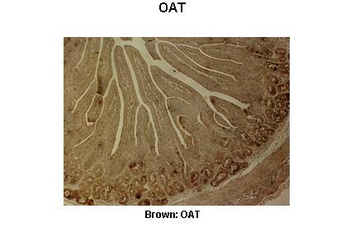 OAT Rabbit Polyclonal Antibody
