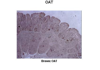 OAT Rabbit Polyclonal Antibody