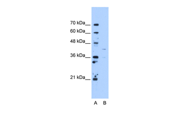 OAT Rabbit Polyclonal Antibody