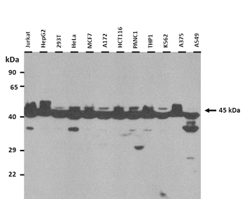 PGK1 Rabbit Polyclonal Antibody
