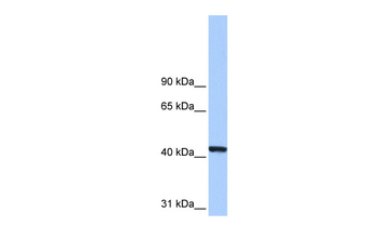 PGK1 Rabbit Polyclonal Antibody