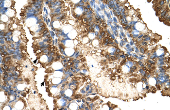 PGK1 Rabbit Polyclonal Antibody
