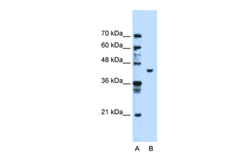 PGK1 Rabbit Polyclonal Antibody