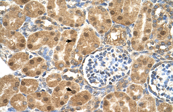 P4HB Rabbit Polyclonal Antibody
