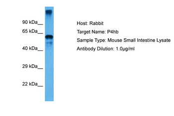 P4HB Rabbit Polyclonal Antibody