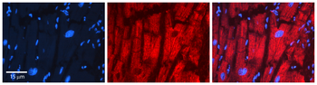 PDHB Rabbit Polyclonal Antibody